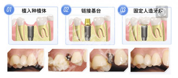 attachments-2019-12-EOHgvNbI5dfc9357090f5.png