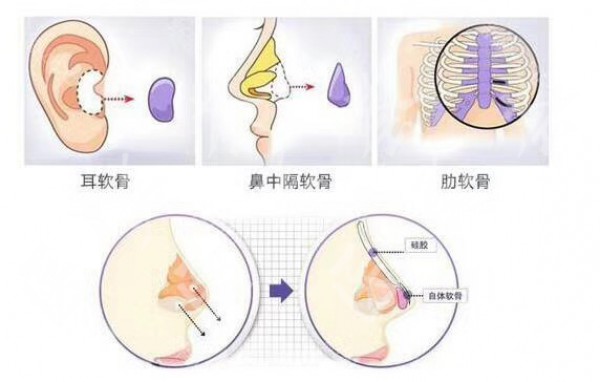 attachments-2019-12-apdiBAAb5df4af9b1be51.jpg