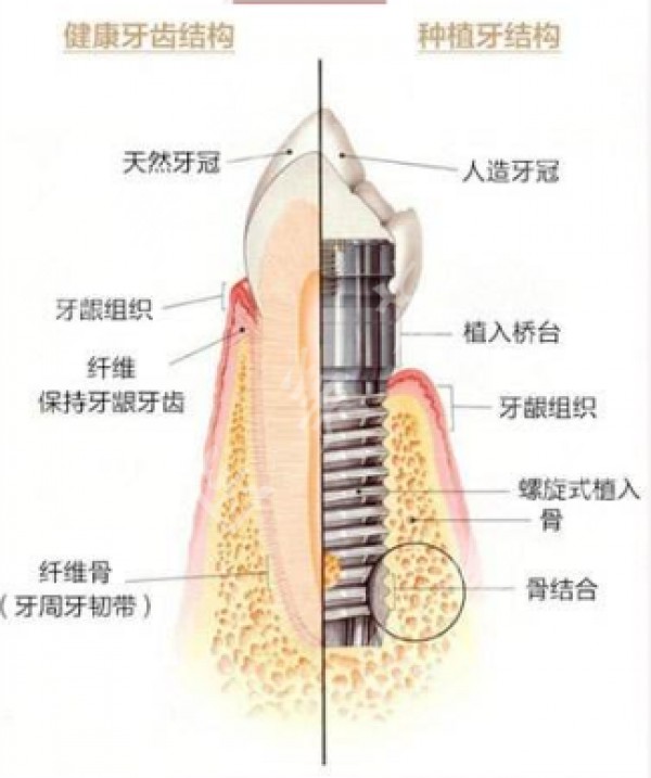 attachments-2020-03-jVn9MI815e6871ea30291.png