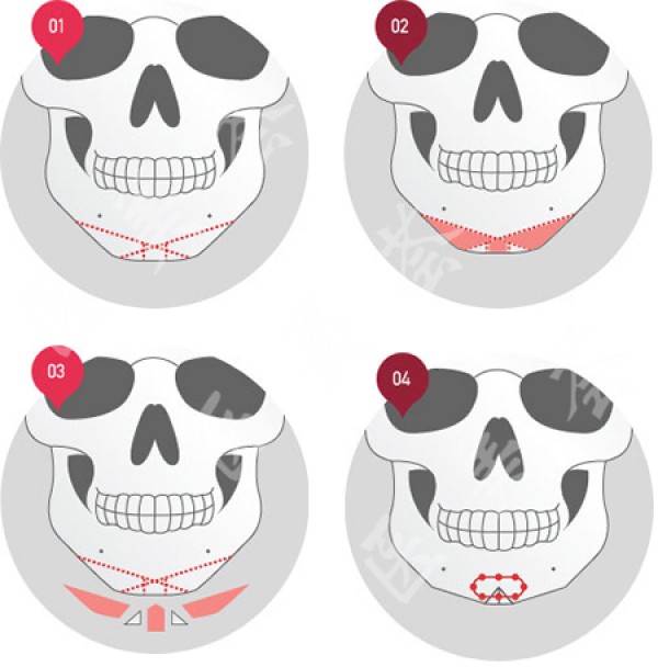 attachments-2020-05-wNYbUsM85eb42009b626d.png