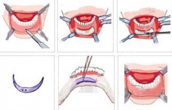 attachments-2020-06-EF9fAQ6z5ed8a9cf68305.png