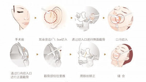 attachments-2020-06-RSrT4NYJ5edf4bfd30929.png